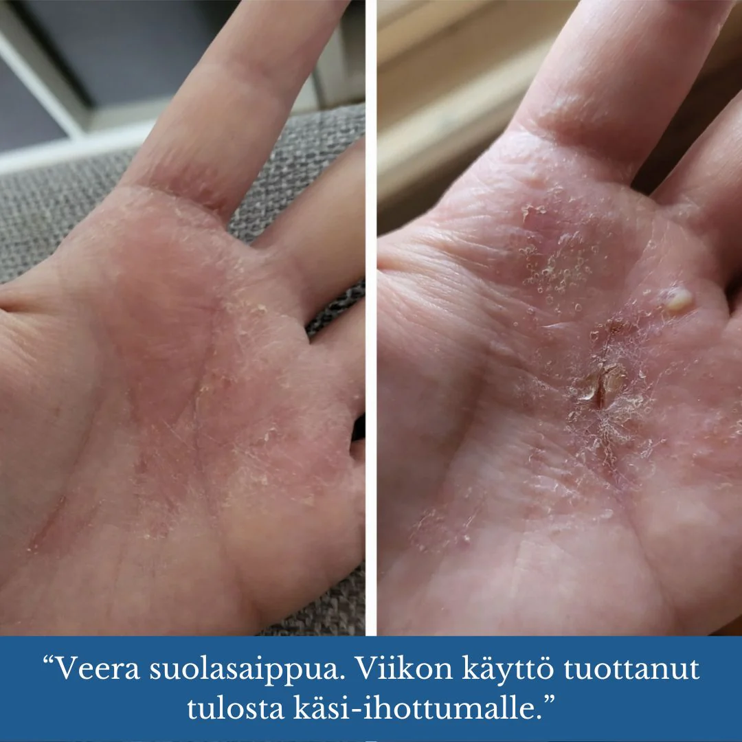 Pikkukuva 2